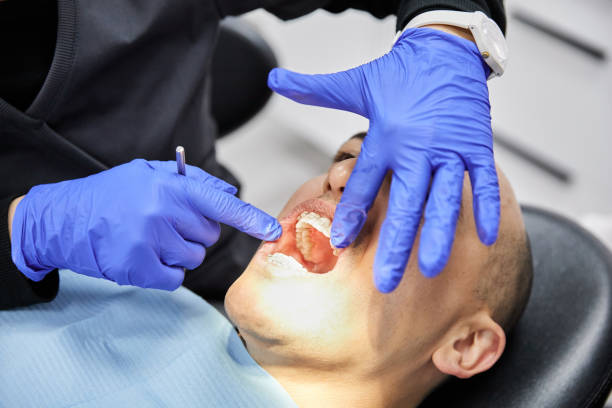 Best Emergency Treatment for Dental Infections or Abscesses in Windsor, CO